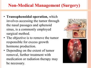 Non-Medical Management (Surgery)
• Transsphenoidal operation, which
involves accessing the tumor through
the nasal passages and sphenoid
sinus, is a commonly employed
surgical method.
• The objective is to remove the tumor
responsible for excess growth
hormone production.
• Depending on the extent of tumor
removal, further treatment with
medication or radiation therapy may
be necessary.
 