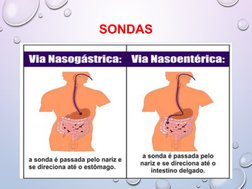 SONDAS
