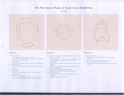 The Three Ba~ie Shape~ of Tooth Crown 1Iorpholo~y
void
,
•
' l
18
,
l
'
J
I
J
I
/
I ,
Labial view