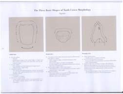 TlH· Three Basie Shupcs of Tooth Crown llorphology
Square
16
-- ..
,
4
I
I ,
I ,
Labial view
I
I
t
• I
lncisal